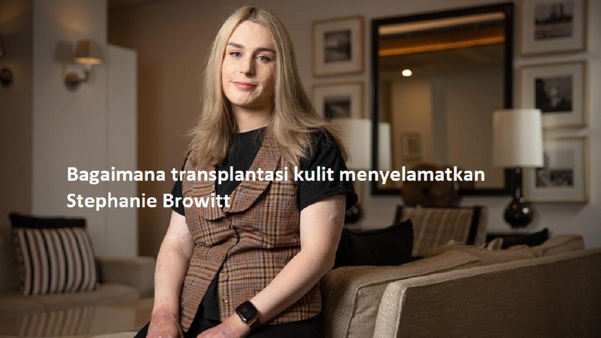 Bagaimana transplantasi kulit menyelamatkan Stephanie Browitt